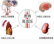 高血压能驾驶证考试吗 高血压可以学车吗