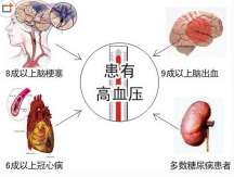 有高血压的能学车吗